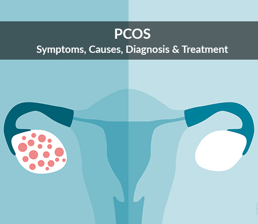 diagnosis and treatment Polycystic Ovarian Syndrome