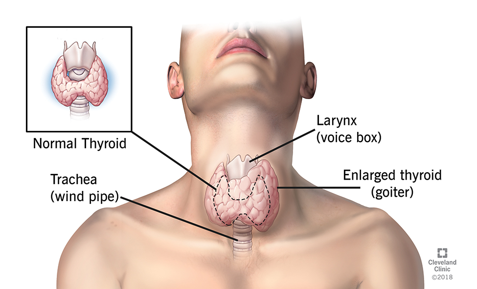 Symptoms of Thyroid