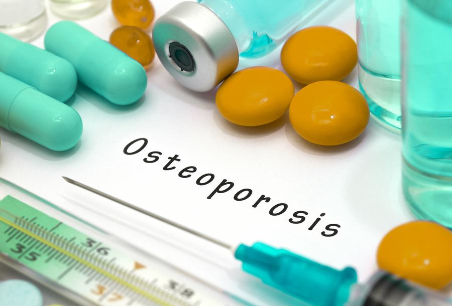What Are Some Risk Factors For Osteoporosis?
