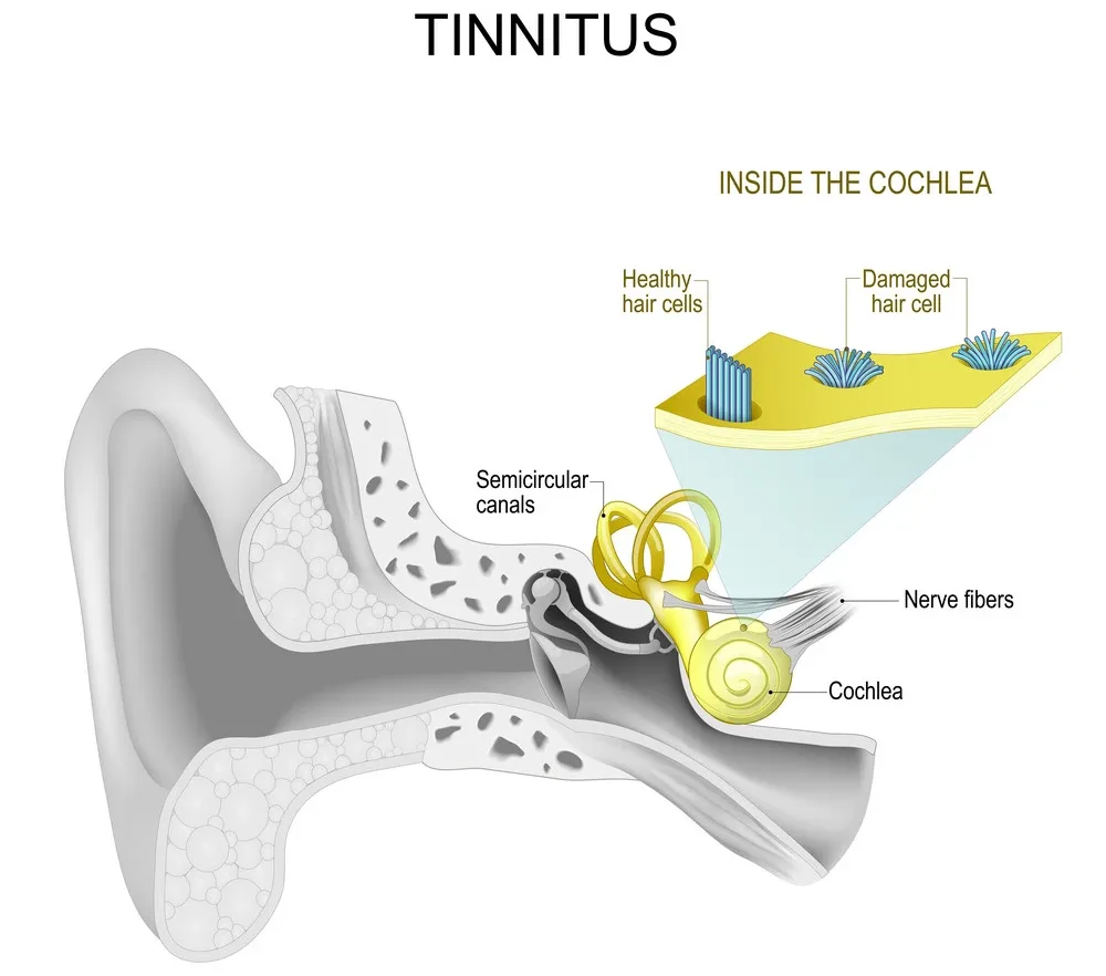 Problems with the inner ear