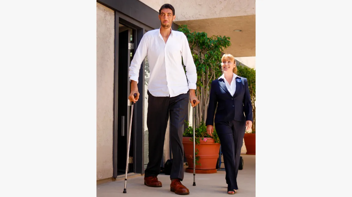 Is there a cure for adult-onset gigantism?