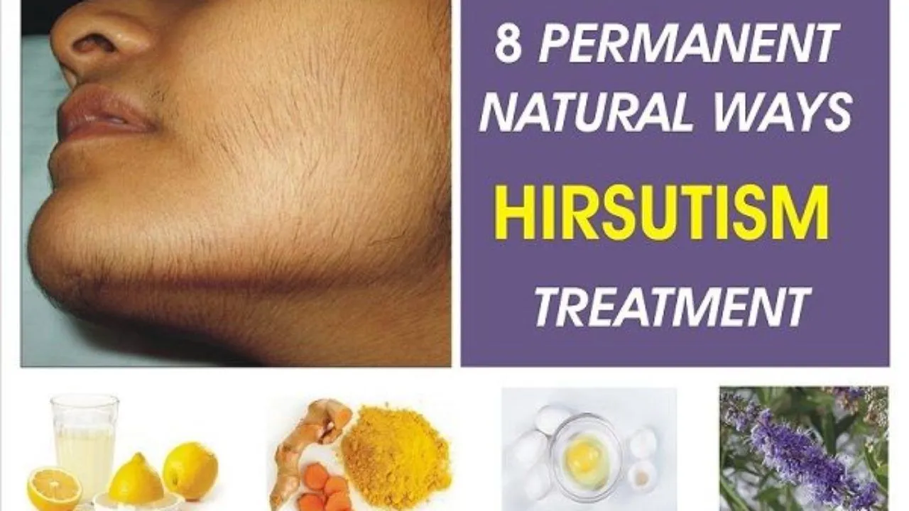 How can one cure hirsutism by natural methods?