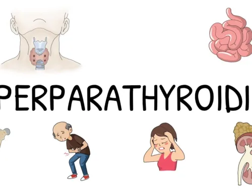 How do I know if I have Hyperparathyroidism?