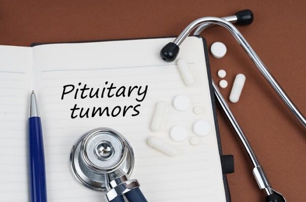 Pituitary Powerhouse: Houston's Top Specialist for Gland Treatment